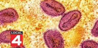 FBI: NIH scientists accused of smuggling monkeypox into US through Detroit Metro Airport